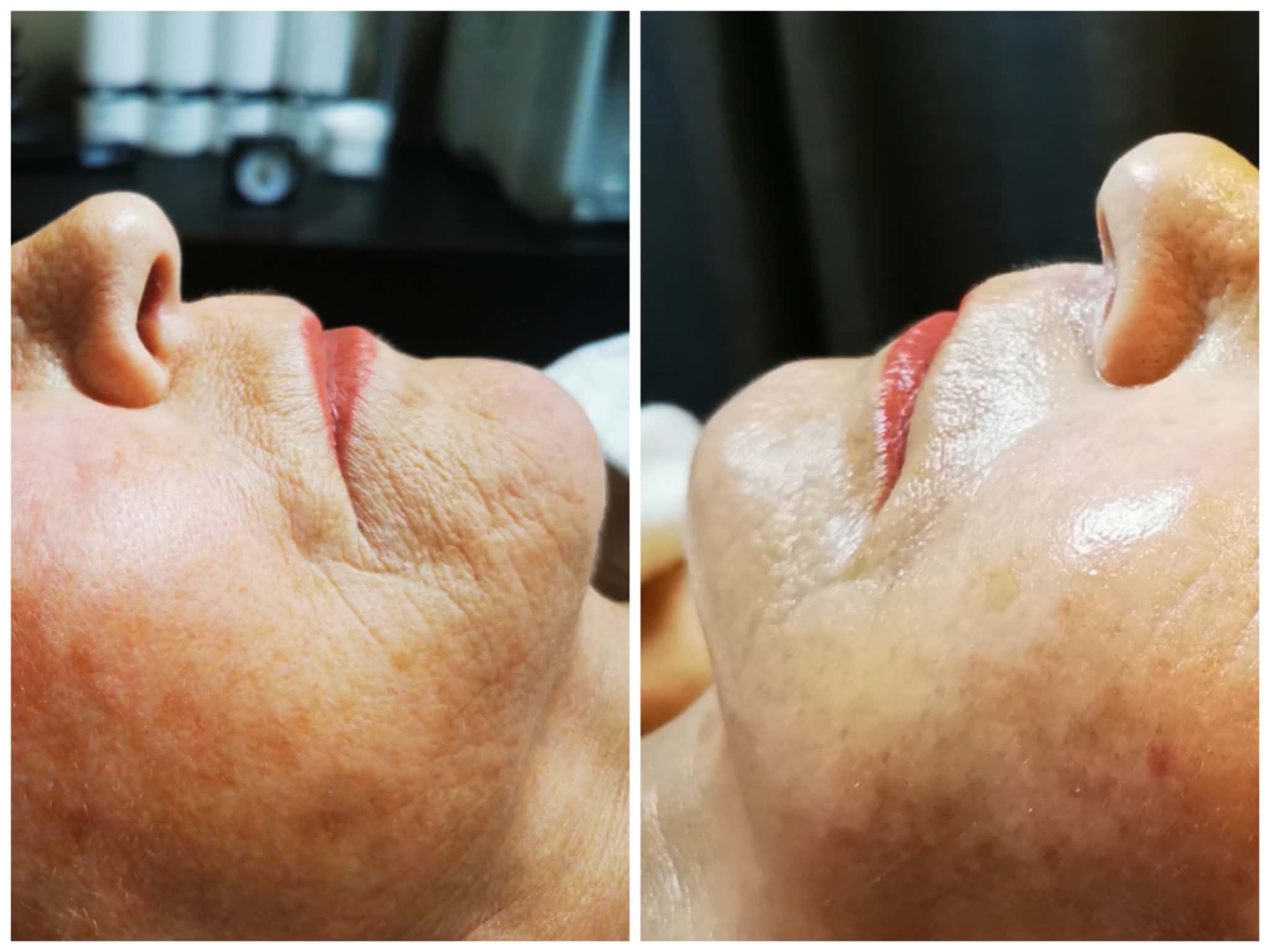 Ritual Anti-Ageing