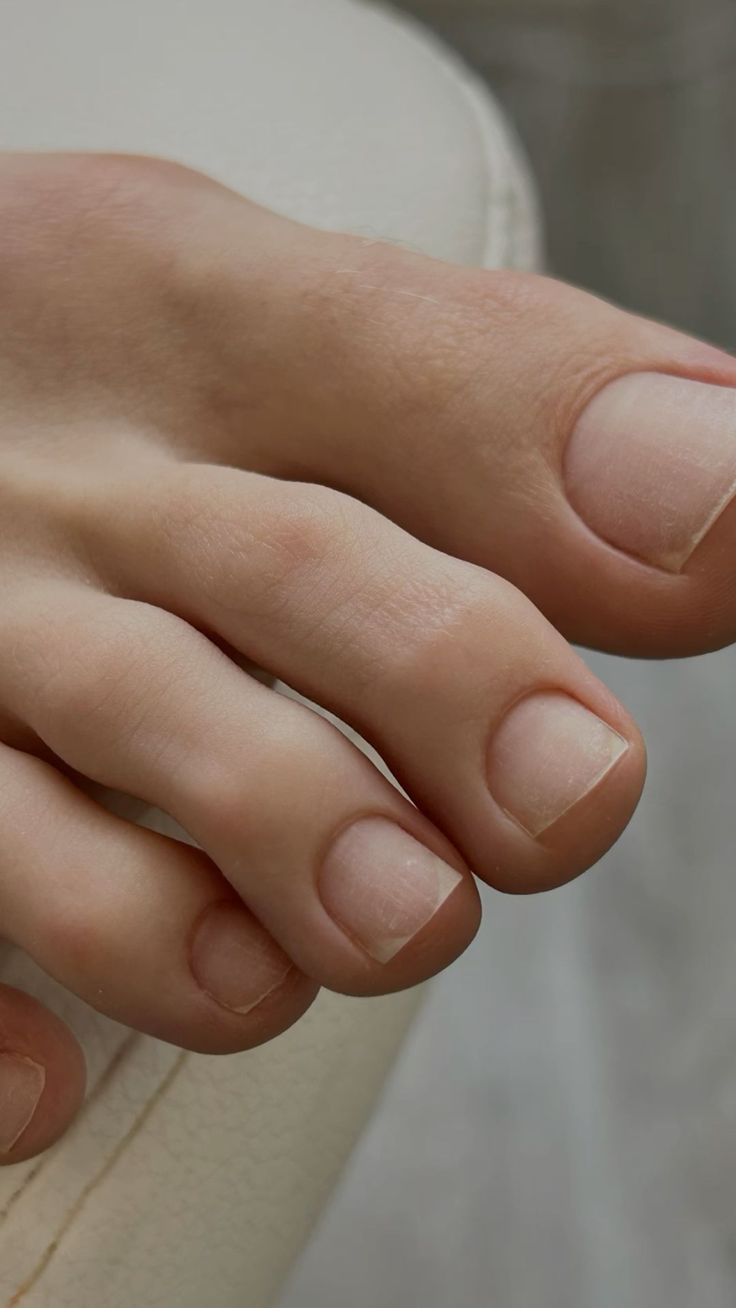 Fjerning av Shellac